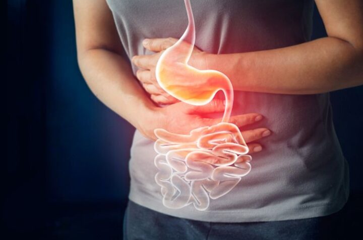 Mengobati Gastritis: Tips Ampuh Meredakan Gangguan Lambung dengan Mudah